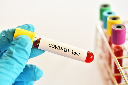 Срочный ПЦР-тест на коронавирус SARS-CoV-2 с ВЫЕЗДОМ 6000 руб